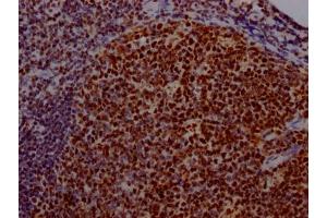 IHC image of ABIN7127535 diluted at 1:100 and staining in paraffin-embedded human tonsil tissue performed on a Leica BondTM system.