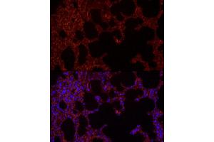 Immunofluorescence analysis of rat lung cells using NLRC4 Rabbit pAb (ABIN6129418, ABIN6144657, ABIN6144659 and ABIN6223243) at dilution of 1:100 (40x lens).