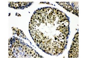 IHC analysis of KDM5B using anti-KDM5B antibody (ABIN4886648). (KDM5B anticorps  (Middle Region))