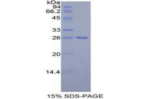 SDS-PAGE (SDS) image for Growth Factor Receptor-Bound Protein 7 (GRB7) (AA 298-489) protein (His tag) (ABIN1878118)