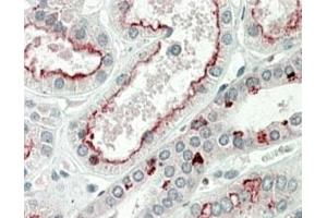 IHC staining of FFPE human kidney with PRAK antibody at 5ug/ml. (MAPKAP Kinase 5 anticorps)