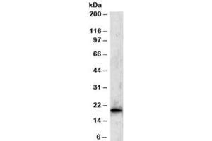 Western blot testing of Jurkat lysate with TBPL1 antibody at 2ug/ml. (TBPL1 anticorps)