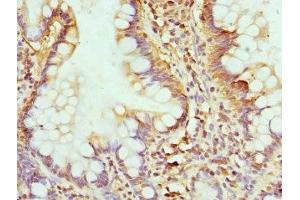 Immunohistochemistry of paraffin-embedded human small intestine tissue using ABIN7154289 at dilution of 1:100 (GMP Synthase anticorps  (AA 394-693))