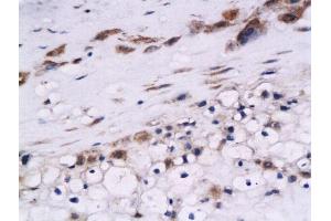 Formalin-fixed and paraffin embedded human placenta labeled with Anti-Cystatin B Polyclonal Antibody, Unconjugated  at 1:200 followed by conjugation to the secondary antibody and DAB staining (CSTB anticorps  (AA 51-98))