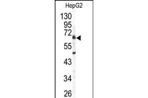 Western blot analysis of ARSB antibody (C-term) (ABIN391670 and ABIN2841581) in HepG2 cell line lysates (35 μg/lane). (Arylsulfatase B anticorps  (C-Term))