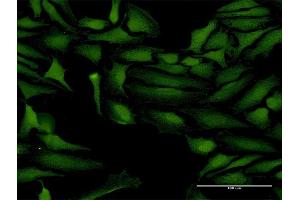 Immunofluorescence of purified MaxPab antibody to ProSAPiP1 on HeLa cell. (ProSAPiP1 anticorps  (AA 1-673))