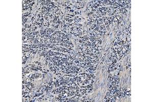 IHC analysis of METTL1 using anti-METTL1 antibody (ABIN7600484).