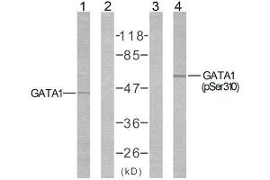 Western blot analysis of extracts from COS7 cells using GATA1 (Ab-310) antibody ( E021042, Line1 and 2) and GATA1 (phospho-Ser310) antibody (E011042, Line3 and 4). (GATA1 anticorps)