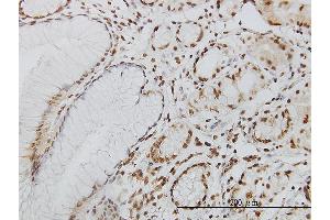 Immunoperoxidase of monoclonal antibody to POLK on formalin-fixed paraffin-embedded human stomach.