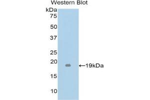 Detection of Recombinant TNFb, Mouse using Polyclonal Antibody to Tumor Necrosis Factor Beta (TNFb)