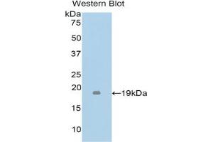 Detection of Recombinant TNFb, Mouse using Polyclonal Antibody to Tumor Necrosis Factor Beta (TNFb) (LTA anticorps  (AA 49-202))