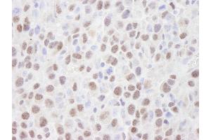 Immunohistochemistry (IHC) image for anti-Histone Deacetylase 2 (HDAC2) (C-Term) antibody (ABIN7448973) (HDAC2 anticorps  (C-Term))