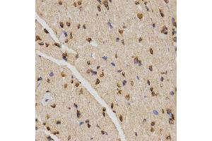 Immunohistochemistry (IHC) image for anti-Histone H4 (3meLys20) antibody (ABIN3016051)