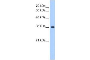 ELOVL7 antibody used at 1. (ELOVL7 anticorps)
