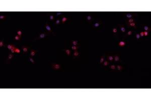 ABIN6266612 staining A-431 cells by IF/ICC. (p63 anticorps  (C-Term))