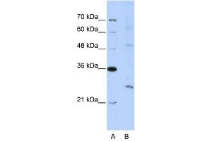 EXOSC4 antibody used at 5 ug/ml to detect target protein. (EXOSC4 anticorps  (N-Term))