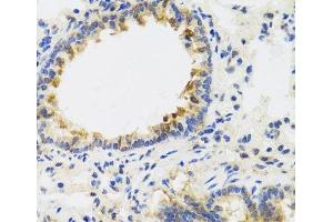 Immunohistochemistry of paraffin-embedded Rat lung using UVRAG Polyclonal Antibody at dilution of 1:100 (40x lens). (UVRAG anticorps)