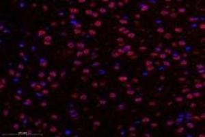 Immunofluorescent analysis of paraformaldehyde-fixed rat substantia nigra using TBXT (ABIN7075815) at dilution of 1: 600