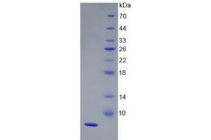 SDS-PAGE analysis of Human HPR Protein. (HPR Protéine)