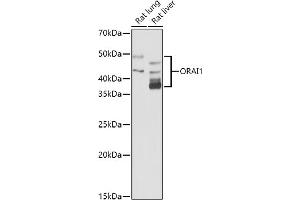Western blot analysis of extracts of various cell lines, using (ABIN6130598, ABIN6145053, ABIN6145055 and ABIN6223281) at 1:1000 dilution. (ORAI1 anticorps  (AA 202-301))