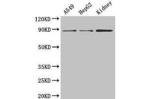 Western Blot Positive WB detected in: A549 whole cell lysate, HepG2 whole cell lysate, Mouse kidney tissue All lanes: ASPH antibody at 3 μg/mL Secondary Goat polyclonal to rabbit IgG at 1/50000 dilution Predicted band size: 86, 35, 26, 24, 34, 84, 30, 22, 29, 33 kDa Observed band size: 86 kDa (Aspartate beta Hydroxylase anticorps  (AA 75-270))
