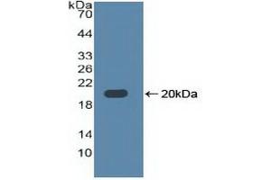 Detection of Recombinant TLR3, Human using Polyclonal Antibody to Toll Like Receptor 3 (TLR3) (TLR3 anticorps  (AA 404-532))