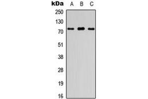 Western blot analysis of FIGNL1 expression in HEK293T (A), Raw264. (FIGNL1 anticorps  (Center))