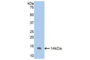 Western blot analysis of recombinant Goat MTNR1A. (Melatonin Receptor 1A anticorps  (AA 312-366))