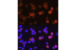 Immunofluorescence analysis of THP-1 cells using CD14 antibody (ABIN6131276, ABIN6138114, ABIN6138115 and ABIN6221406) at dilution of 1:100.