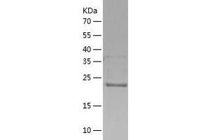 Western Blotting (WB) image for HIV-1 Tat Interactive Protein 2, 30kDa (HTATIP2) (AA 1-242) protein (His-IF2DI Tag) (ABIN7123349)