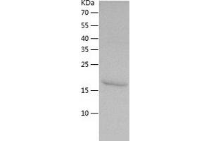 Western Blotting (WB) image for Tumor Necrosis Factor Receptor Superfamily, Member 1A (TNFRSF1A) (AA 22-212) protein (His-IF2DI Tag) (ABIN7125553)