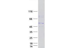 Validation with Western Blot