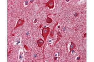 Anti-Cytochrome c antibody IHC of human brain, cortex.