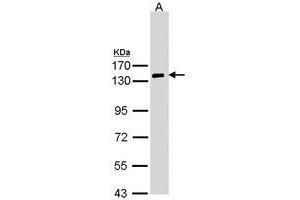 Image no. 1 for anti-Natriuretic Peptide Receptor A/guanylate Cyclase A (Atrionatriuretic Peptide Receptor A) (NPR1) (AA 669-924) antibody (ABIN467525) (NPR1 anticorps  (AA 669-924))