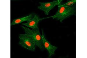 IF analysis of SNRNP27 and Tubulin beta using anti-SNRNP27 antibody (ABIN7599614) and anti-Tubulin beta antibody (ABIN7602744). (SNRNP27 anticorps  (AA 100-155))