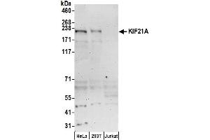 anti-Kinesin Family Member 21A (KIF21A) (AA 1-50) antibody