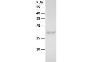 Western Blotting (WB) image for HD Domain Containing 2 (HDDC2) (AA 1-204) protein (His tag) (ABIN7123258) (HDDC2 Protein (AA 1-204) (His tag))