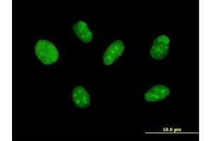 Immunofluorescence of purified MaxPab antibody to ZNF471 on Daoy cell.