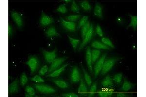 Immunofluorescence of monoclonal antibody to TIMP2 on HeLa cell. (TIMP2 anticorps  (AA 27-220))