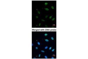 ICC/IF Image Immunofluorescence analysis of paraformaldehyde-fixed HeLa, using MCM7, antibody at 1:200 dilution. (MCM7 anticorps)