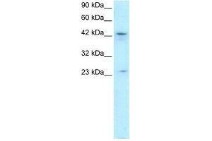Human HepG2; WB Suggested Anti-ZNF365 Antibody Titration: 0.