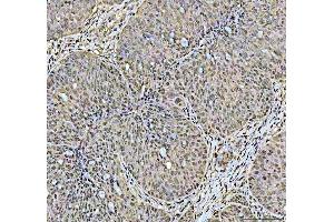 IHC analysis of DCK using anti-DCK antibody (ABIN5693016). (DCK anticorps  (AA 17-260))
