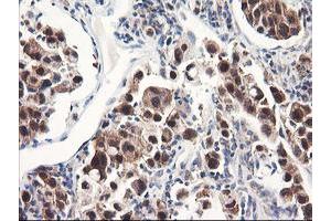 Image no. 8 for anti-F-Box Protein 21 (FBXO21) antibody (ABIN1498232) (FBXO21 anticorps)