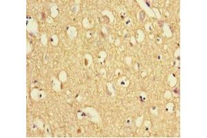 Immunohistochemistry of paraffin-embedded human brain tissue using ABIN7172010 at dilution of 1:100 (TXNDC9 anticorps  (AA 1-188))