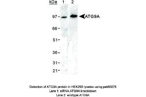 Image no. 1 for anti-ATG9 Autophagy Related 9 Homolog A (S. Cerevisiae) (ATG9A) (AA 750-839), (C-Term) antibody (ABIN363584)