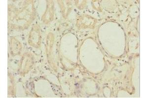 Immunohistochemistry of paraffin-embedded human kidney tissue using ABIN7160192 at dilution of 1:100 (MGLL anticorps  (AA 1-303))