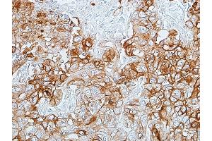 Immunohistochemistry (IHC) image for anti-Carcinoembryonic Antigen-Related Cell Adhesion Molecule 1 (CEACAM1) (AA 35-433) antibody (ABIN7455148) (Recombinant CEACAM1 anticorps  (AA 35-433))