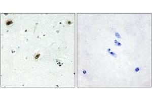 Immunohistochemistry (IHC) image for anti-C-Abl Oncogene 1, Non-Receptor tyrosine Kinase (ABL1) (AA 861-910) antibody (ABIN2889373) (ABL1 anticorps  (AA 861-910))