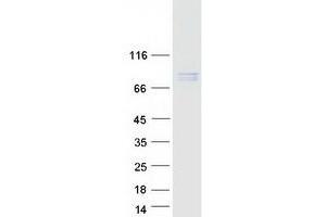 Validation with Western Blot