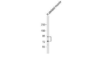 Anti-LTK Antibody (S57) at 1:2000 dilution + human skeletal muscle lysate Lysates/proteins at 20 μg per lane.